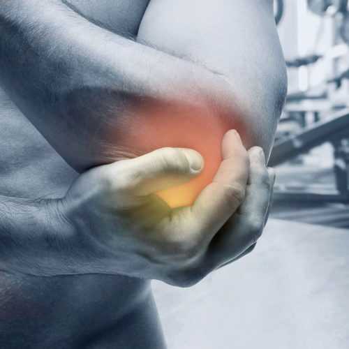 A patient suffering with tennis elbow. Treatments are available from Tom Claykens at Biddenden Chiropractic.